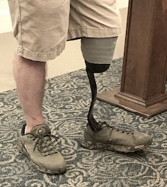 View of Jeff Sprinkle's prosthetic leg.